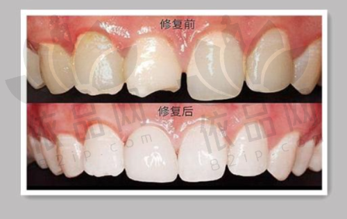 宁波江北牙科医院正规吗
