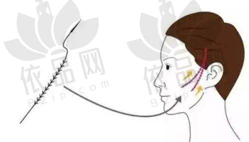 宁波鄞州卓美医疗美容门诊部——交通路线