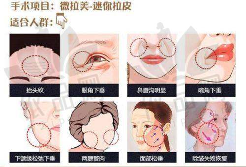 1、戴传昌医生