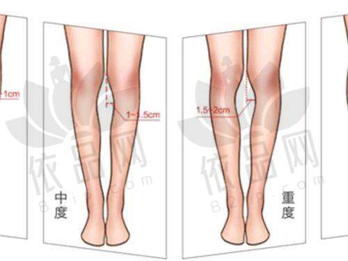 三、附加项目价格表（按需求选择）