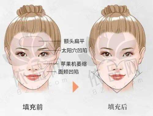 沈阳杏林耳部整形医院价格表