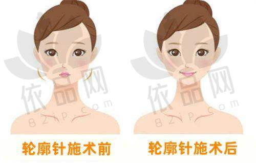余姚妍美柏合医疗美容诊所正规吗