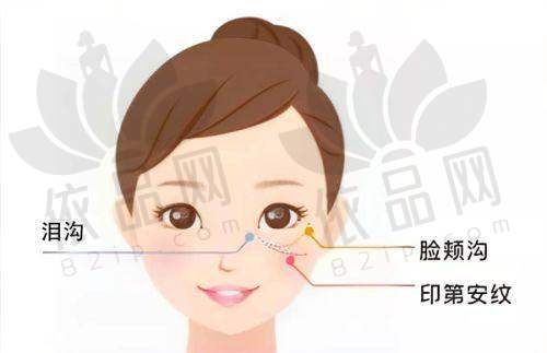 陈小剑：精细化修复“细节控”