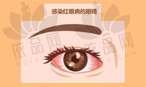 兰大二院眼科好医生名单及擅长领域