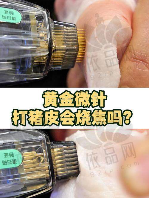 总结
