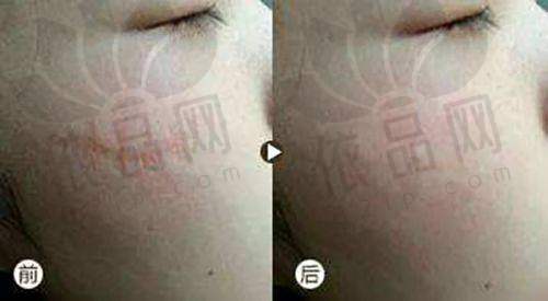 温州乐清艾美时光医疗美容门诊部医院收费价格表