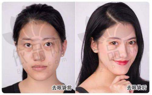 温州百佳东方整形医院怎么样