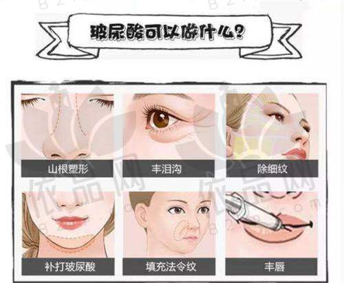 6、合肥维多利亚整形外科医院卫爱侠医生