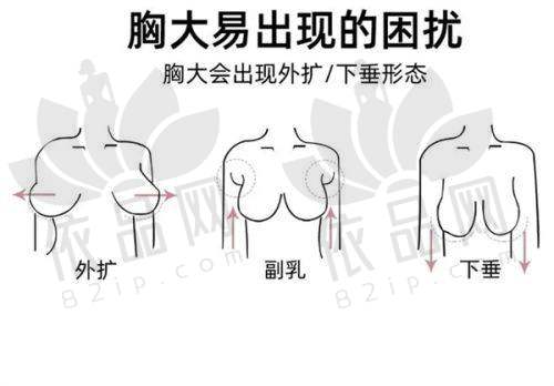 余姚妍美柏合医疗美容沈光源医生 - 医生口碑评价