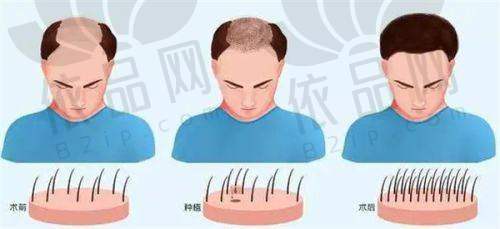 温州美添臣植发门诊部医生团队