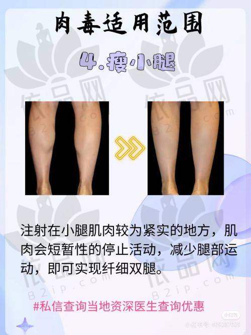 活动时间和有效期