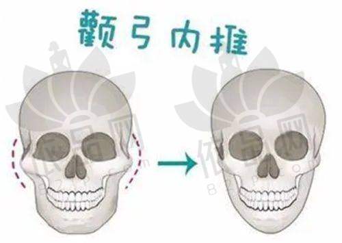 适用人群