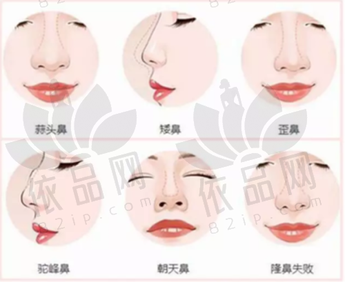 用户口碑与总结