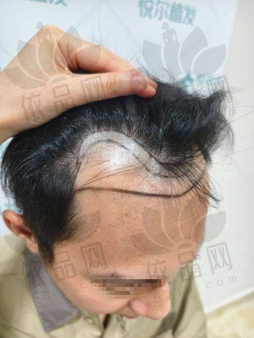 温州美添臣植发门诊部营业时间