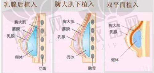 3. 多样选择多