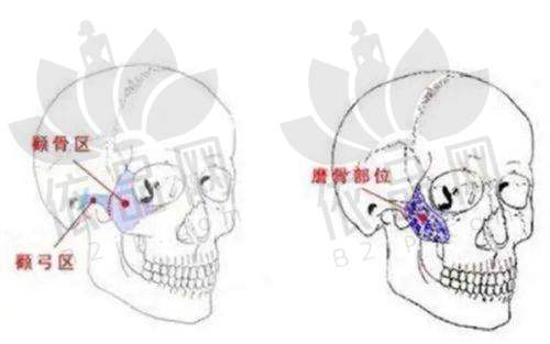 一、眼部整形价格