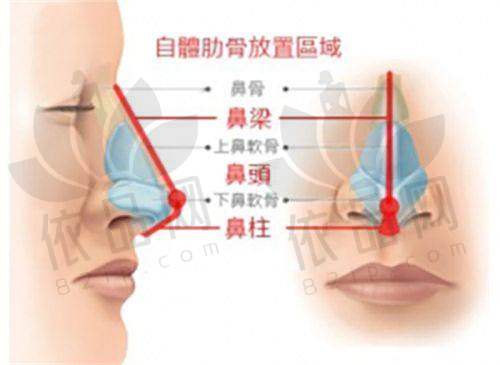 微针和嗨体治疗价格不同