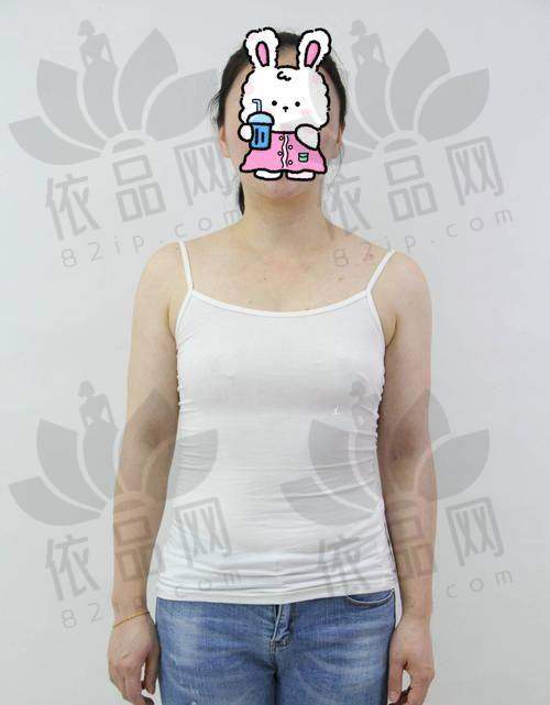 总体而言，美国纽赛尔假体隆胸在可靠性、自然感、持久性和多样性方面优势明显，适合追求美丽与自信的女性。不过，选择假体和医生时要谨慎，确保符合自身需求。隆胸手术作为提升自我形象的方式，能带来积极的心理效益，助女性实现美丽梦想。如果您正在考虑隆胸手术，不妨将纽赛尔假体作为可靠之选，在正规医生的指导和合理的术后护理下，定能在求美路上一帆风顺。