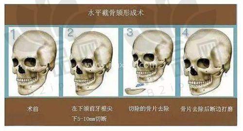 湖州恒颜美整形医院交通路线