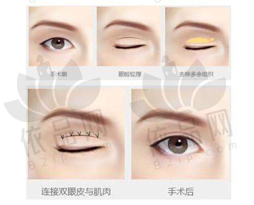 绍兴维美美容医院预约方式