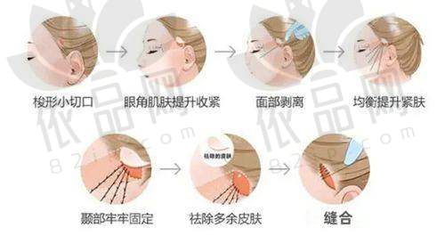 目录二：重点介绍郑州面部脂肪填充出色的医生