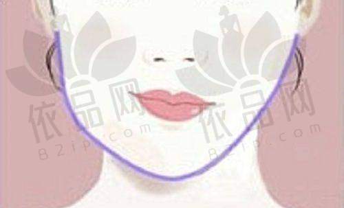 诸暨西子美整形医院收费价格表