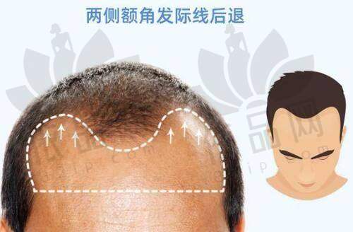 金华义乌秀壹医疗美容门诊部正规吗