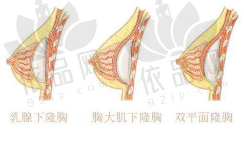 丽水芘丽芙整形外科孙尚成医生 — 技术与服务优势