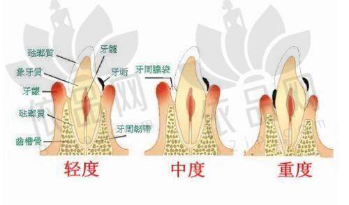 诸暨西子美整形刘士红医生的特色技术优势