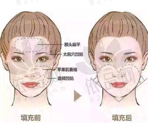 绍兴上虞艺美医疗美容王玄宇医生特色技术优势
