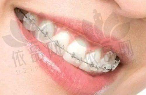 看牙优势凸显