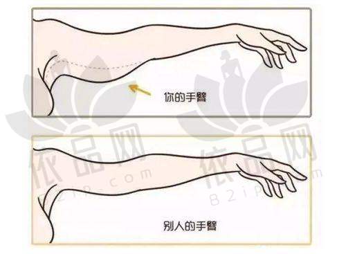 金华瑞丽做双眼皮的医院优势