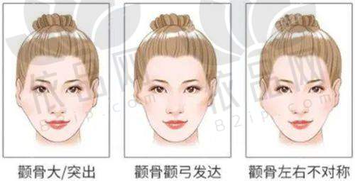 6、东莞叶子柯玉金医生