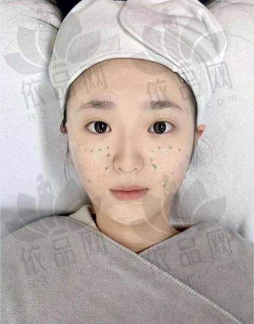舟山艾美医疗美容光子嫩肤的优势