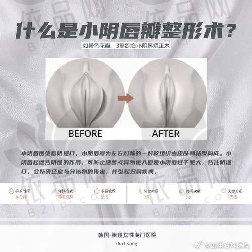盆肌底修复优惠项目详情