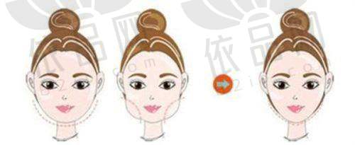 瞿健医生预约方式
