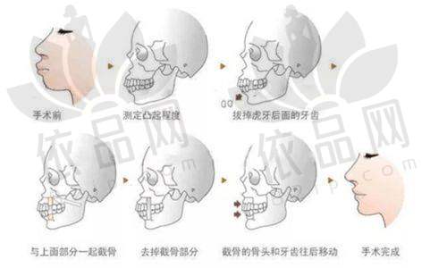 如何预约徐怀河医生