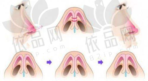 手术价格：合理透明，项目多样