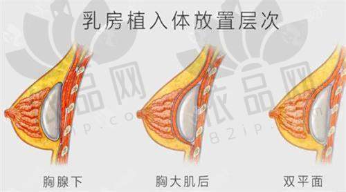 重庆当代牙祖蒙隆胸价格多少？隆胸价格3万起，技术靠谱受众多顾客认可