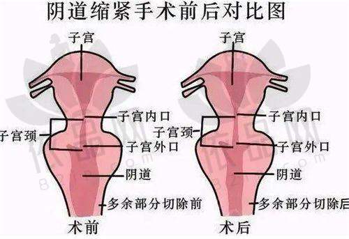 重庆当代整形姜北医生特色技术优势