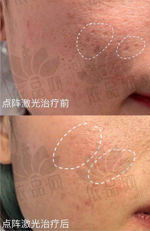 广州艺星医疗美容邓晟华医生——擅长项目