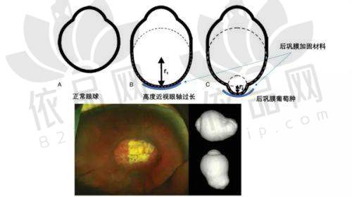 福州东南眼科医院近视手术价格