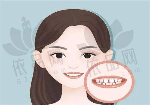 深圳慈恩口腔杨林医生特色技术优势