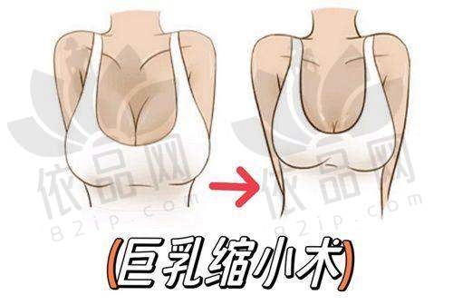 总结
