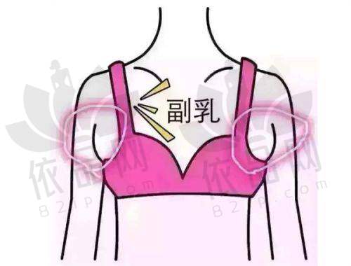 总结