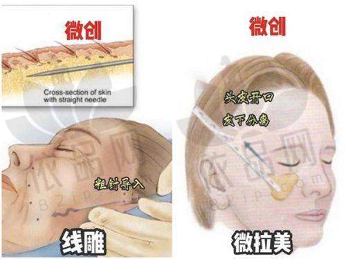 口碑与影响力