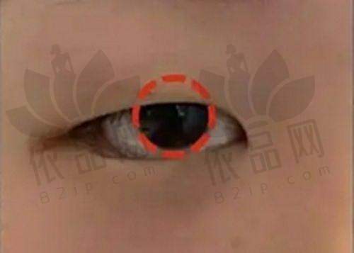 麻醉方式影响整体费用