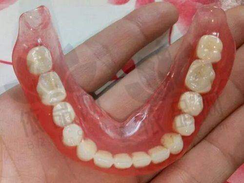 池州安美口腔拔智齿价格优势