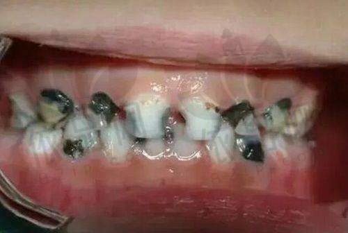 福州维乐口腔门诊部(连江分院)正规吗