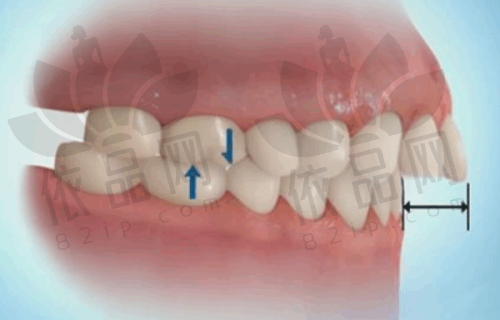 福州维乐口腔门诊部（中街亭总店）预约方式